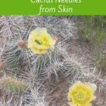 Cactus Needles Under Skin? How to Remove Them Safely